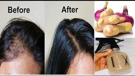 1625928220 507 تقویت رشد مو و جلوگیری از ریزش مو با زنجبیل تقویت رشد مو و جلوگیری از ریزش مو با زنجبیل